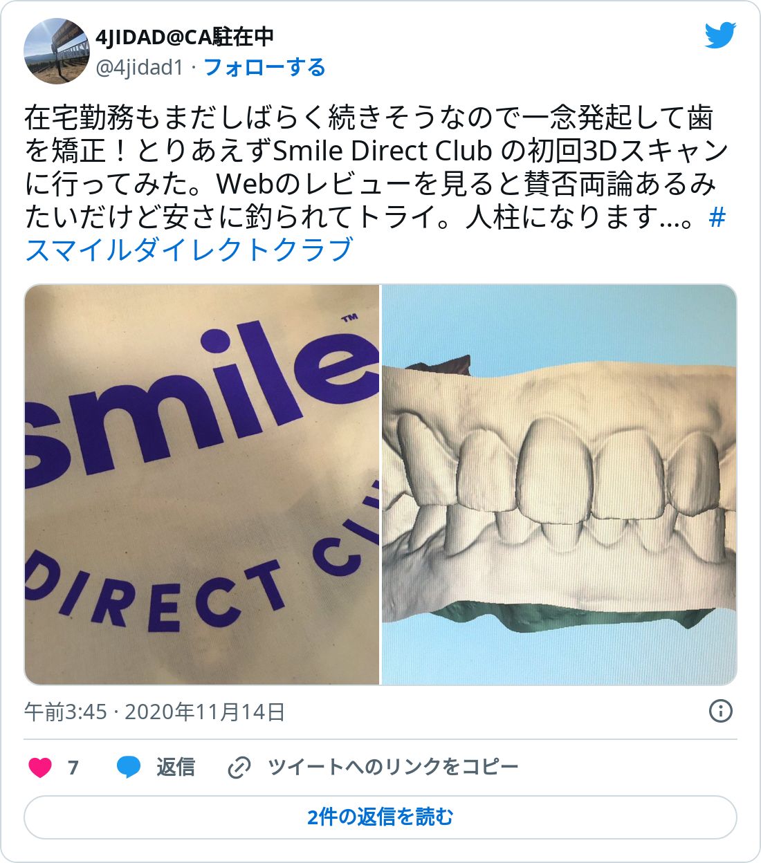 週末限定直輸入♪ smile direct club ホワイトニング スマイル